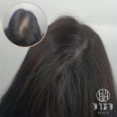 명지헤어라인
