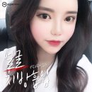 티오피성형외과의원 | 신사역성형외과 얼굴지방흡입 후기는 못참지