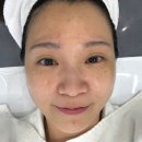일산대화동피부관리샵 알엔뷰티랩&amp;스칼프디자인센터 일산피부관리 받은 솔직 후기