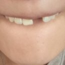 충주열린치과의원 이미지