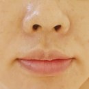 결라인뷰티 | [수원]결뷰티 (shop&academy)/헤어라인 왁싱 (2달후기) 바쁜 일상 속 왁싱과 피부관리를인계동 토탈뷰티...