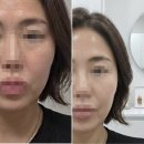 대원메디테크 수원점 | 40대 피부관리, 홈케어만으로 부족하다면? 인계동 에이블메디스킨 내돈내산 솔직 후기