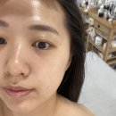 화성남양피부관리맛집 블랑드보떼 유산균 테라피추천 물방울초음파 스케일링 솔직후기 할인 및 주차정보
