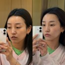 뷰티스에스테틱 | 광주 상무지구 피부관리 찐추천｜뷰티스 에스테틱 연예인미백관리, 이브이시너지 리얼후기 피부과에서...
