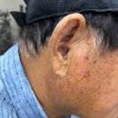 스타키보청기포항점 이미지