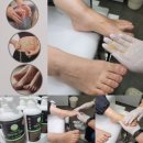 만성골프연습장 | [강남] 압구정 무좀치료 발톱무좀 골프무좀 올리미의원 속시원해~
