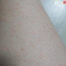 공주네백반 | 빛고을 여성병원 임신 24주 초음파, 임신당뇨검사, 임산부 독감 주사