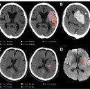 제이엘케이 이미지