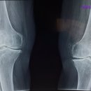희망요양병원 | 서울 요양병원 추천 - 희망요양병원 서울 요양병원 추천 - 믿을 수 있는 곳