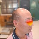 주연 | 천안가발 만족도가 다른 평가를 받는 에띠모, 항암가발 전문 주연헤어 후기