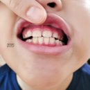 이튼치과의원 이미지