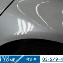 덴트존 이미지