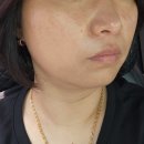 대전피부관리 고민이라면? 데이미즈 바이오포톤 대전서구점 데이프팅 3종 솔직후기
