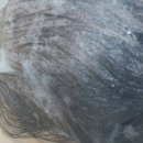 빠짐플러스 | 🧴PX 내돈내산 탈모샴푸 추천 닥터포헤어 폴리젠 플러스 3달사용 솔직후기 머리빠짐 고민 해결템 ✨