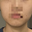 성실리프트 | 홈모드 써마 리프트 내돈내산 사용 후기 2주 차