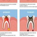 구취 입 냄새 원인 10가지 이미지