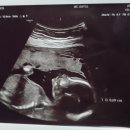 노블5 산후조리원 이미지