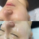 바이밍 이미지