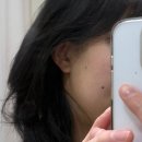 미엘스킨 | 일산) 정발산 피부관리, 도테라오일, 건조한 여드름 피부, MTS 후기여드름 피부관리후기[미엘스킨앤바디]