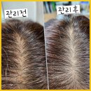 수빈메디칼 | 안산피부관리 수빈에스테틱, 피부 건강하게 날개를 달아주다