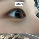브로우블라썸
