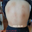 민제약국 | 피부질환으로 고통받고 있는 울 아이들