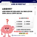 오늘 10월 29일(화) &#39;뇌졸중의 날 &#34;골든타임은 &#39;무조건 빨리&#39; 이미지