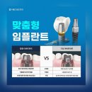 닥터최 치과보존과 치과의원 | 당산동치과 임플란트, 선택이 고민이라면 이것부터 확인