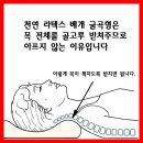 목디스크로 고생하는 사람들을 위한 베개 이미지