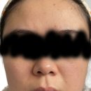 마음톡의원 | 남포 제이린의원 엄마 울쎄라 리얼후기