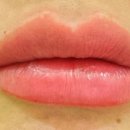 누브의원 이미지