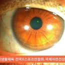 이침생활이침요법과 아름다운눈 건강을 말해요홍채임상학 저자최만규는 초급과정을 (6주) 수강료1만원으로 이침강의 이미지