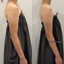 성남대로331번길 | 분당 정자역 에스테틱 #에스테틱다리아분당정자점 #팔뚝관리만족후기