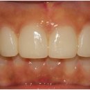 한플러스치과기공소 이미지