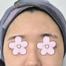 엄궁파출소 | 사상 이곳,피부샵🔆 기미잡티관리⚡️ 비포에프터 있음❄️ 미백토닝까지❣️