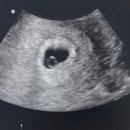 서초엘산부인과의원 이미지