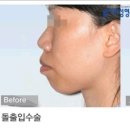 디오메디 이미지