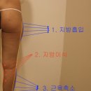 파이안의원 네이버블로그