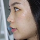 나노필의원 이미지