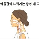 목에 이물감이 느껴지는 증상, 도대체 왜 그럴까? 대표 원인 4가지 이미지