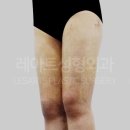 레아트성형외과의원 이미지