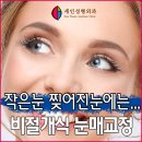 세인성형외과 이미지