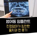 더 율 | 부모님과 다녀온 수성구 임플란트, 율치과 범어동 임플란트 후기