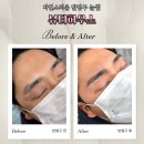 금하로23길 | [금천구 눈썹] 자연스러운 눈썹 문신 뷰티하우스 솔직 후기 I 반영구, 주차, 가격