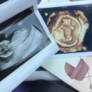 맘존산후조리원 이미지