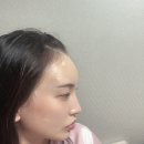 강남피부과 이마필러후기 뉴스타의원