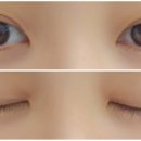 미인케어