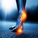 피트니스 인앤스타 이미지