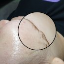 세라네일 이미지