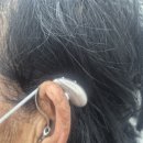 전주벨톤보청기 이미지